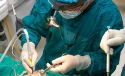 Viêm amidan có thể tái phát khi thực hiện cắt amidan phẫu thuật không triệt để