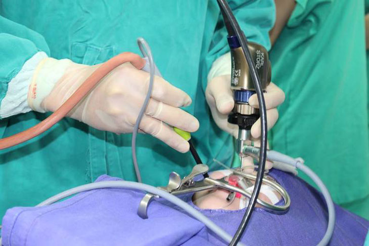 Chi phí phẫu thuật cắt amidan bằng plasma phụ thuộc vào nhiều yếu tố như cơ sở y tế, xét nghiệm ban đầu,...