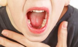 Cắt amidan xong có được đánh răng không? – Thông tin chi tiết