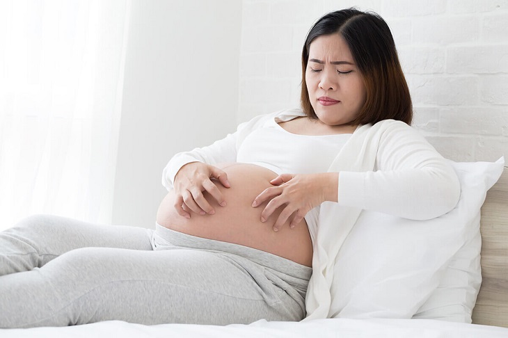 Nổi mề đay khi mang thai là dạng bệnh ngoài da phổ biến ở bà bầu.