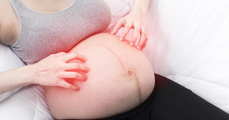 Ngứa bụng khi mang thai nên làm gì cho đúng?