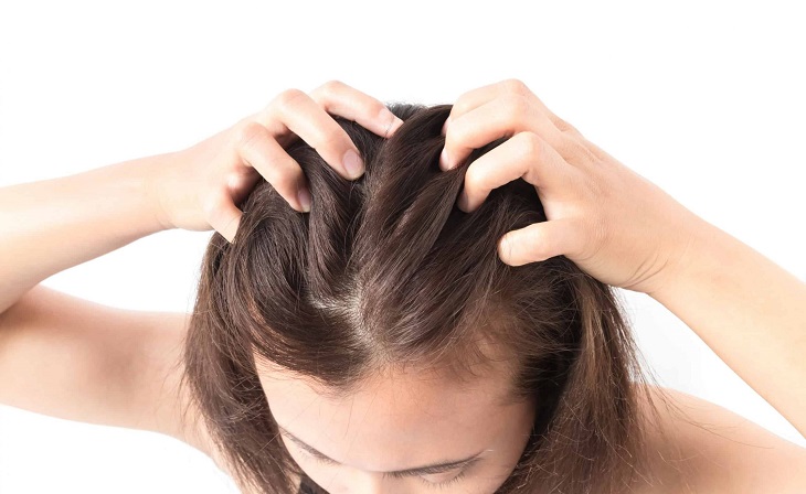 Ngứa da đầu là bệnh gì? Nguyên nhân và cách chữa trị