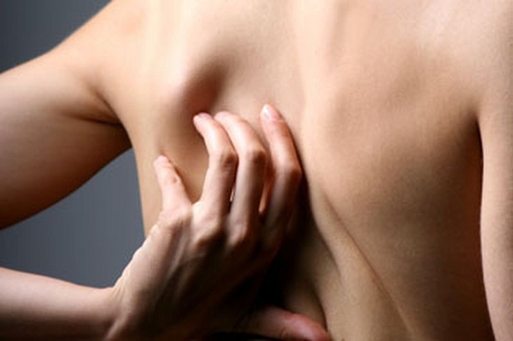Có nhiều nguyên nhân gây ngứa lưng