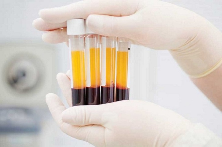 Test huyết thanh tìm các kháng thể IgG đặc hiệu