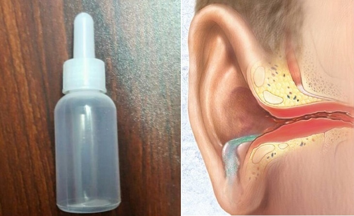 Top 9 loại thuốc nhỏ viêm tai giữa an toàn và hiệu quả