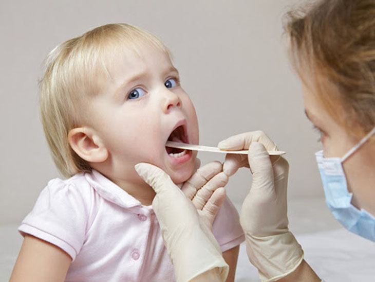 Trẻ bị viêm họng - bệnh lý hô hấp thường gặp
