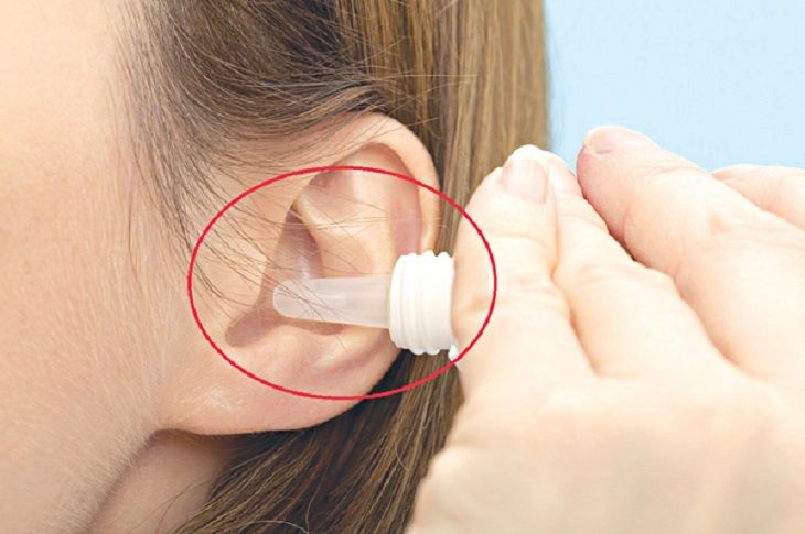 Vệ sinh tai sạch sẽ để hỗ trợ điều trị và phòng ngừa viêm tai giữa