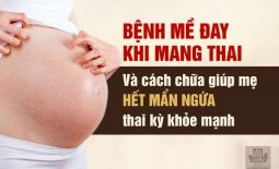 Cách chữa mề đay khi mang thai hiệu quả cho mẹ bầu