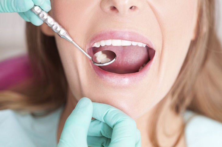 Khi mắc các triệu chứng răng miệng cần điều trị triệt để 
