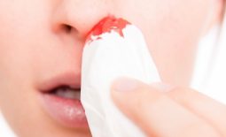 Viêm xoang cấp gây chảy máu mũi có nguy hiểm không?