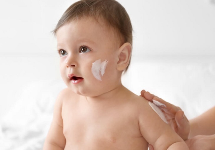 Đối với trẻ sơ sinh nên điều trị bằng bôi kem dưỡng ẩm theo hướng dẫn của bác sĩ