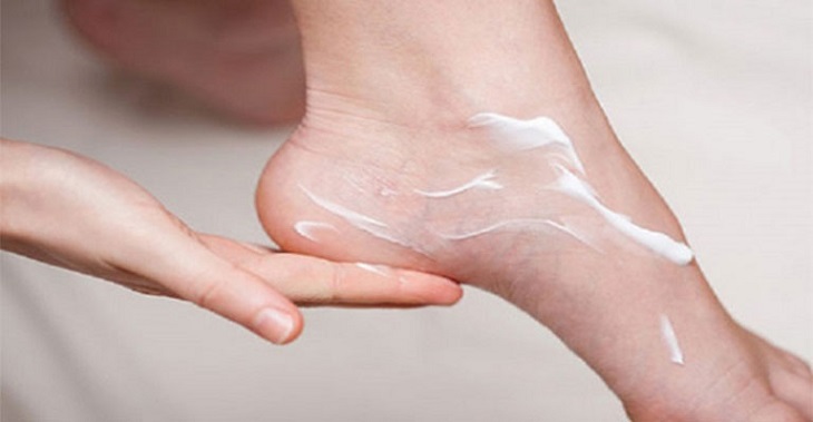Người bệnh cần sử dụng thuốc điều trị tại chỗ và dưỡng ẩm da chân để chữa và phòng ngừa tổ đỉa