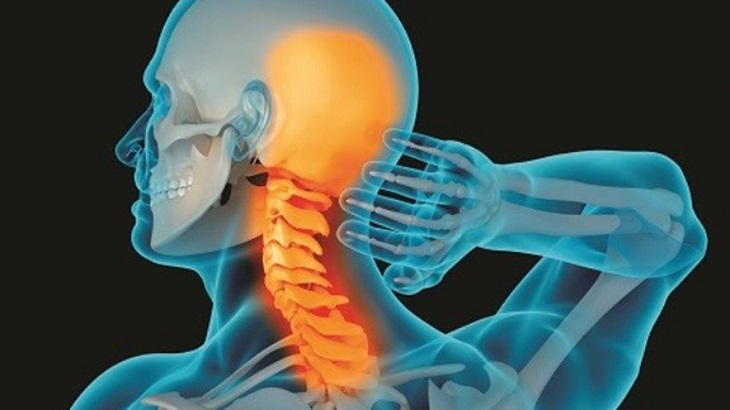 Các bệnh lý về xương khớp là nguyên nhân phổ biến và nguy hiểm gây ra đau cổ khi ngủ dậy