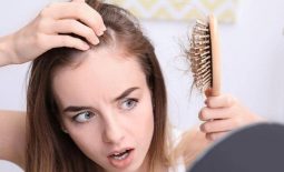 Viêm da tiết bã gây rụng tóc