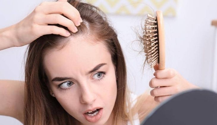 Viêm da tiết bã gây rụng tóc