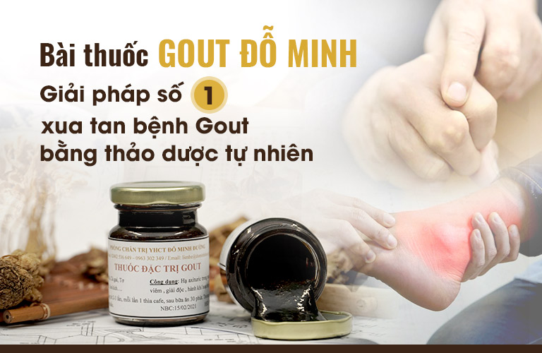 Bài thuốc Gout Đỗ Minh - Giải pháp Vàng cho người bệnh gout