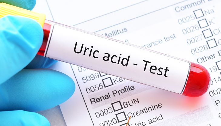 Acid uric được hình thành do phân hủy purin