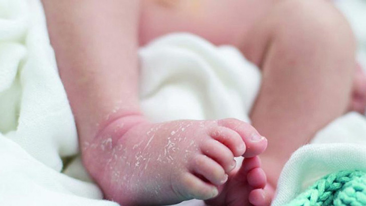 Nguyên nhân cơ bản của bệnh khô da ở trẻ sơ sinh là do da bị mất độ ẩm dẫn đến da bị nứt và bong tróc lớp biểu bì
