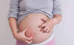 Nổi mề đay khi mang thai khiến mẹ bầu khó chịu, sức khỏe bị ảnh hưởng