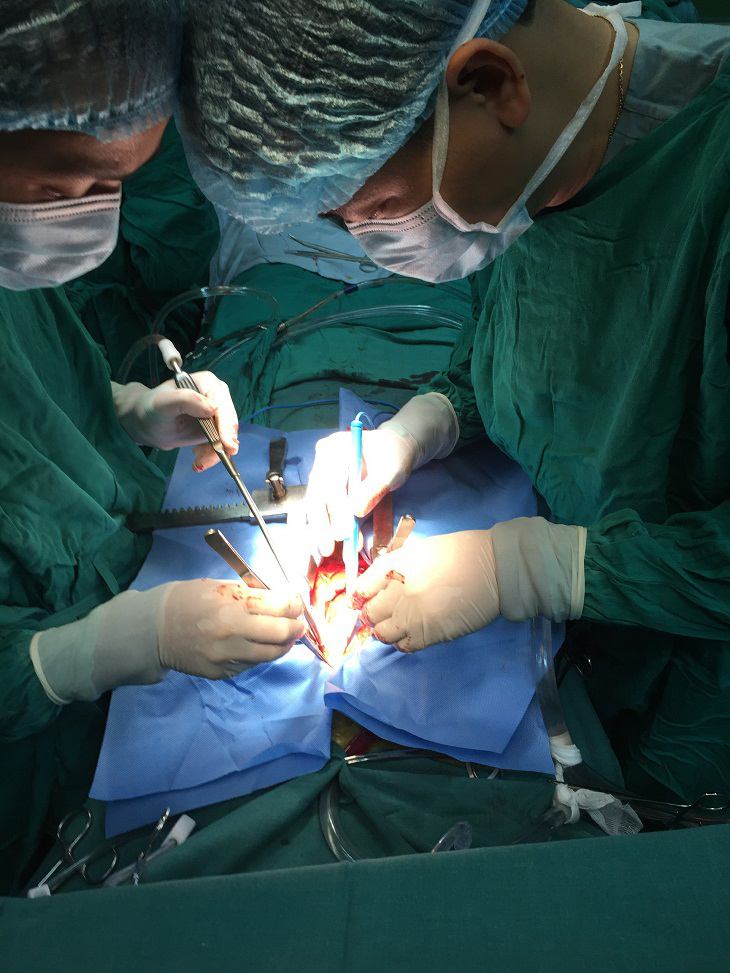 Phẫu thuật phình lóc động mạch chủ type A là một phẫu thuật nguy hiểm và phức tạp