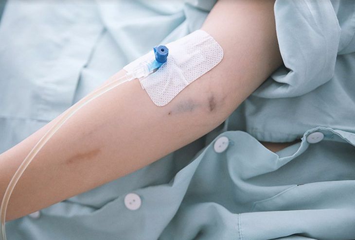 Bệnh nhân có thể được truyền tiểu cầu nhằm xử lý nhiễm trùng máu