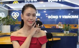 Làn da của chị Trang đã hồi sinh trở lại sau khi điều trị tại Viện Da liễu Hà Nội - Sài Gòn