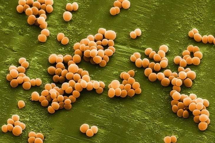 Vi khuẩn tụ cầu kháng nhiều loại kháng sinh được dùng nhiều để điều trị nhiễm trùng tụ cầu khuẩn thông thường