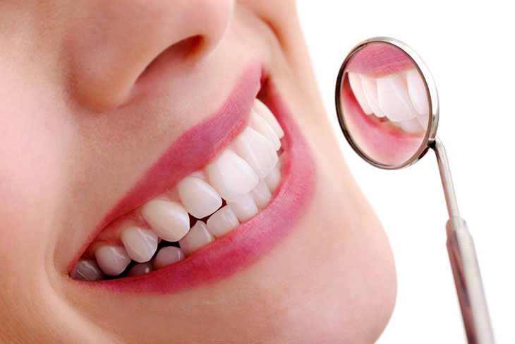 Bọc răng sứ giúp loại bỏ tình trạng răng bị ố vàng, xỉn màu theo thời gian