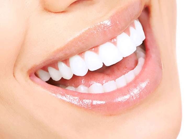 Quy trình trồng răng sứ như thế nào? Chăm sóc sau khi trồng răng