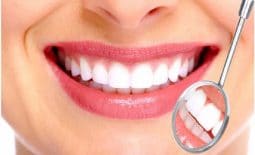 Giải đáp trồng răng sứ mất bao lâu để hoàn thiện?