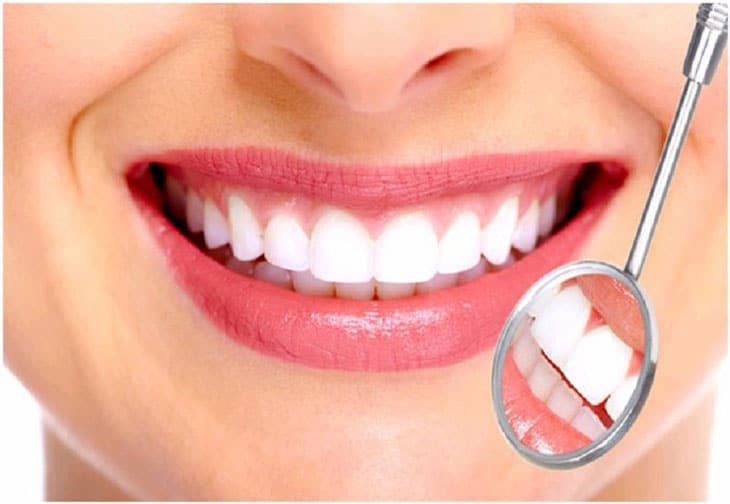 Giải đáp trồng răng sứ mất bao lâu để hoàn thiện?