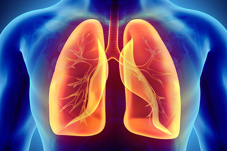 Kỹ thuật mở màng phổi tối thiểu là thủ thuật giúp giải phóng khoang màng phổi