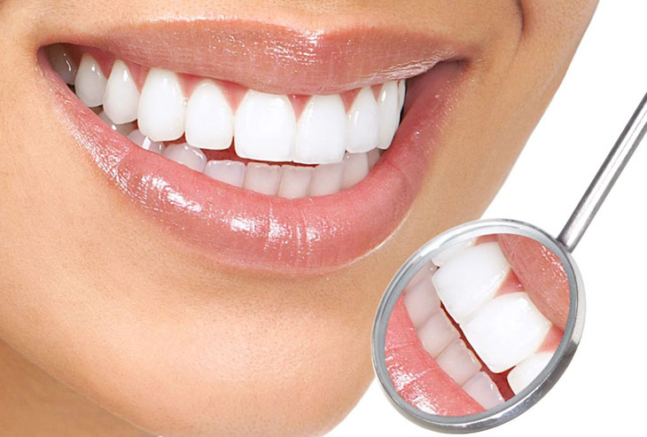 Bọc sứ để bảo tồn răng và cải thiện thẩm mỹ