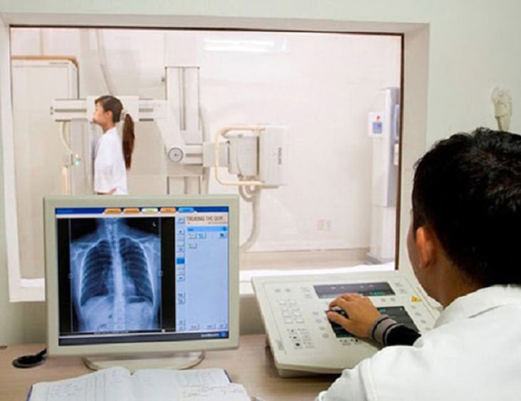 chụp X quang ngực trong bệnh lý tim mạch sẽ có 3 tư thế cơ bản