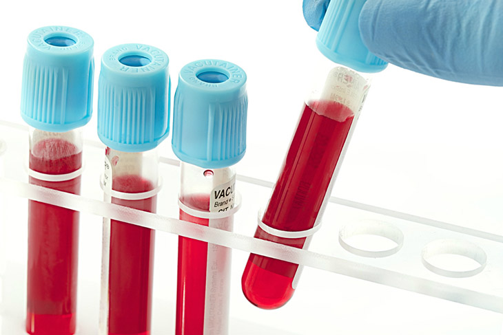 Xét nghiệm máu là phương pháp chẩn đoán bệnh