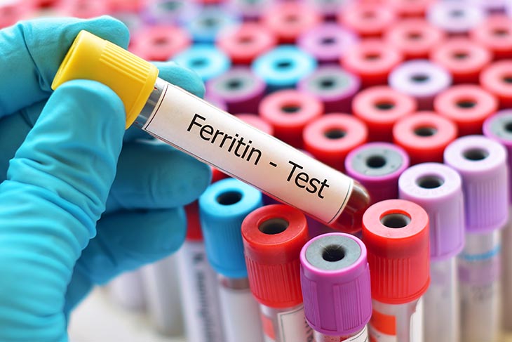 Ferritin là protein dự trữ sắt có mặt ở hầu hết các cơ quan