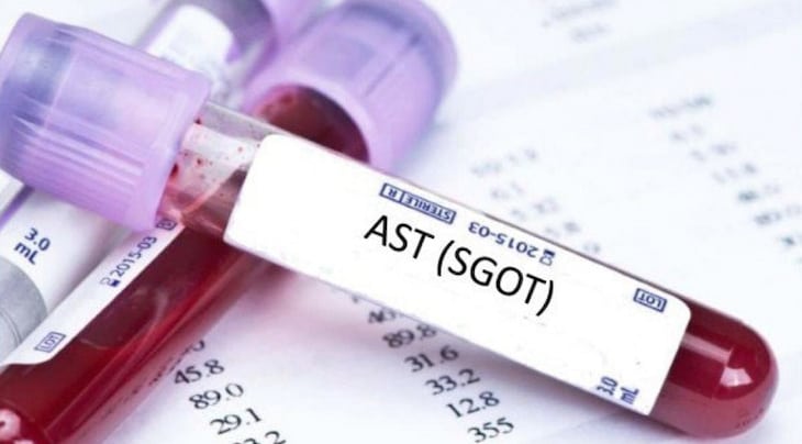 Nồng độ AST trong máu cao là dấu hiệu đầu tiên của bệnh lý về gan