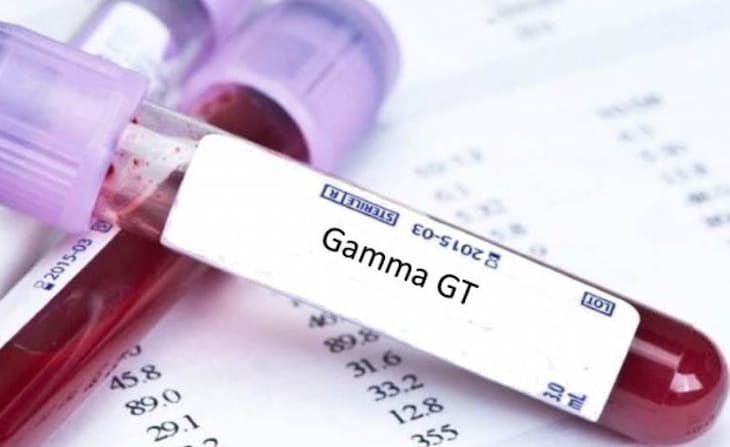 Nồng độ GGT tăng cao đột ngột là dấu hiệu của tất cả các bệnh lý gan mật