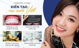 ViDental Clinic - Trung Tâm Bọc Răng, Dán Răng Sứ Công Nghệ Hiện Đại