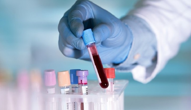 Xét nghiệm máu giúp chẩn đoán bệnh chính xác