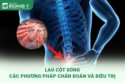 lao cot song