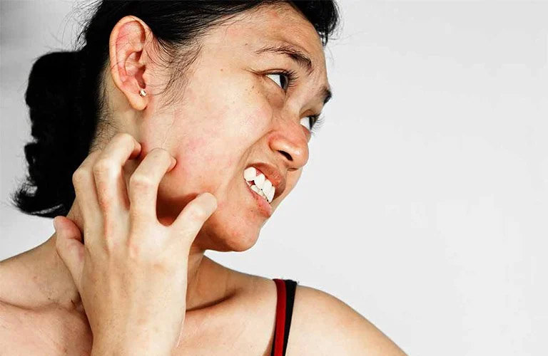 Da mặt bị ngứa là hiện tượng da liễu phổ biến