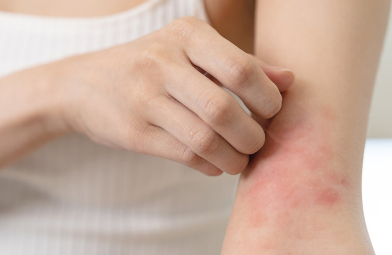 Ngứa da là cảm giác khó chịu hoặc cần được gãi ở bề mặt của da