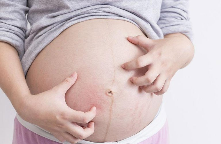 Mang thai có thể gây ngứa ngáy ngoài da
