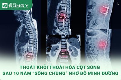 hinh-anh-thoat-khoi-thoai-hoa-cot-song-10-nam-nho-do-minh-duong-1