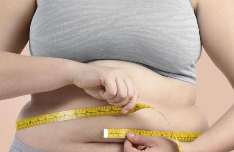 Người béo phì dễ mắc bệnh viêm da vùng kín