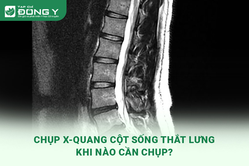 x-quang-cot-song-that-lung