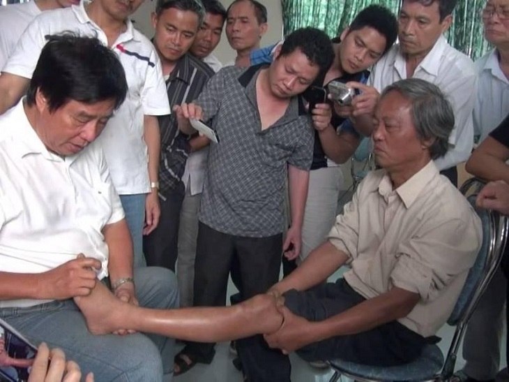 Bác sĩ Dư Quang Châu mở nhiều khóa đào tạo, truyền dạy phương pháp chữa thoát vị đĩa đệm
