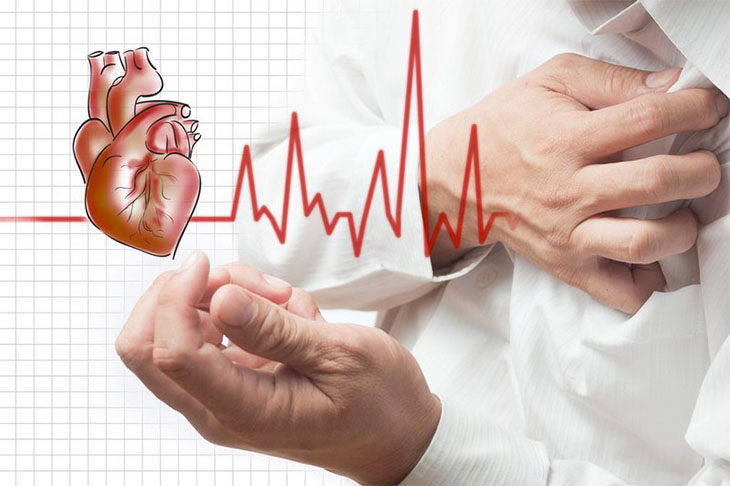 Chèn ép tim cấp gây ngừng tuần hoàn ở bệnh nhân