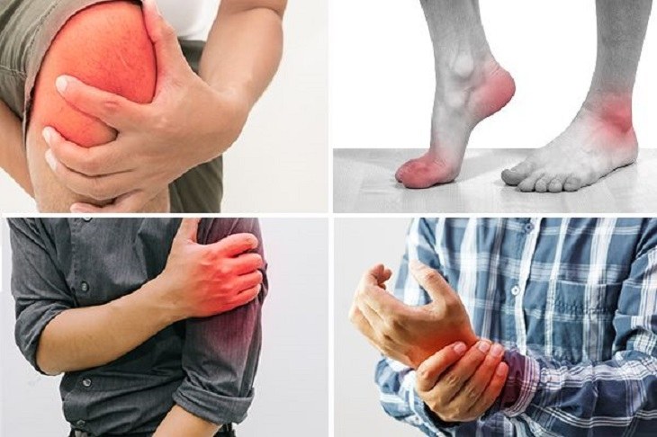 Đau nhức xương khớp tê bì chân tay khiến người bệnh vô cùng khó chịu